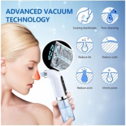 USB Rechargeable Blackhead Remover Vacuum Pore Cleaner - Effortless Pore Cleansing and Skin Rejuvenation image