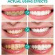Teeth Whitening Mousse with Baking Soda - Brighten Your Smile Naturally image