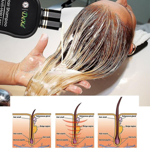 Dexe Herbal Anti Hair Loss Growth Unisex Shampoo - 200ml image