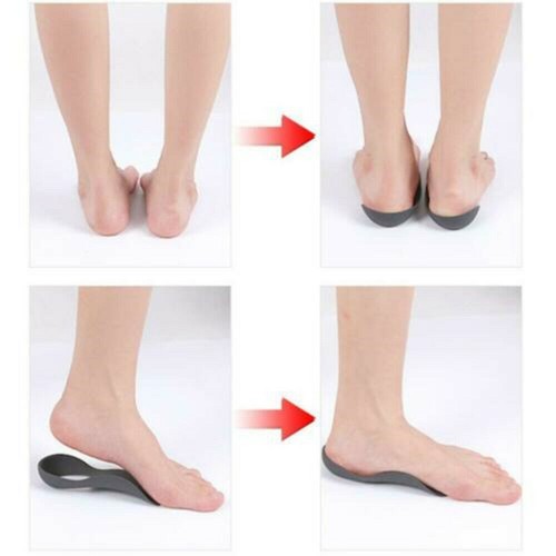 Flat Feet Orthopedic Insoles image