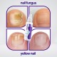 Medinail Nail Repair Spray Advanced Foot Hand And Toenail Repair Spray 3.38 Fl Oz image