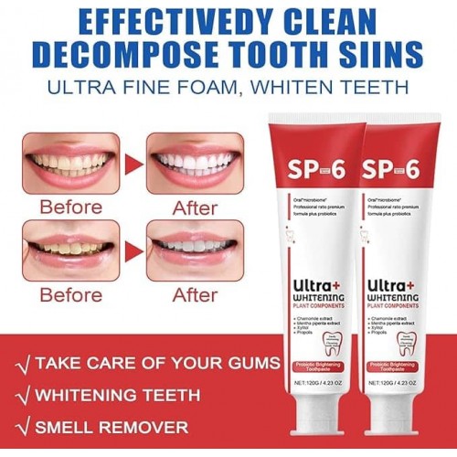 SP-6 Probiotic Whitening Toothpaste – Advanced Whitening and Probiotic Oral Care