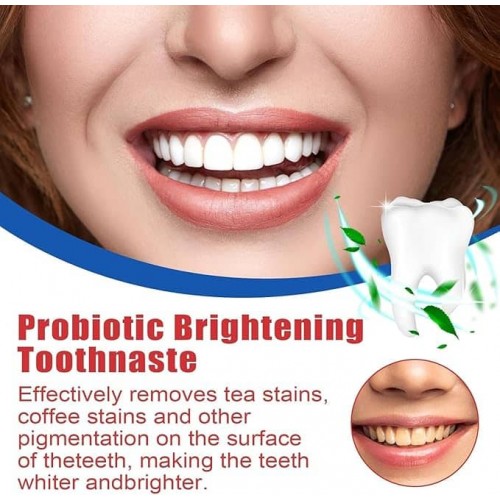 SP-6 Probiotic Whitening Toothpaste – Advanced Whitening and Probiotic Oral Care