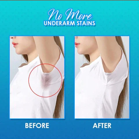 Effective Underarm Sweat Pads for Odor and Wetness Control image