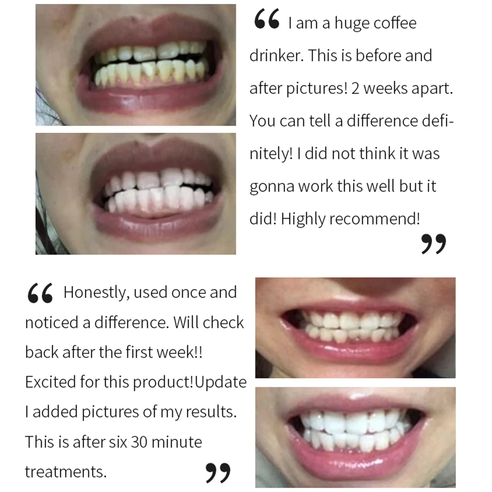 Teeth Whitening Mousse - Brighten Your Smile with Our Gentle Formula image